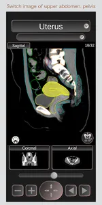CT Passport Abdomen / sectiona screenshot 4