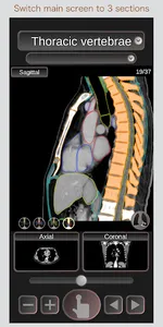 CT Passport Chest / sectional  screenshot 3