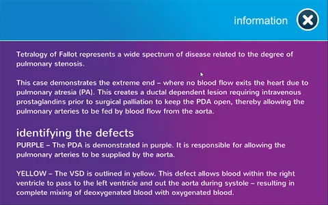 3D Printed Heart App screenshot 2