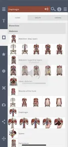 Primal's 3D Abdomen screenshot 1