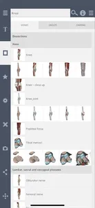 Primal's 3D Knee screenshot 1