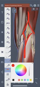 Primal's 3D Knee screenshot 3