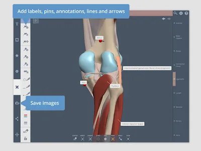 Primal's 3D Knee screenshot 7