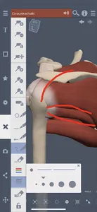 Primal's 3D Shoulder & Arm screenshot 3
