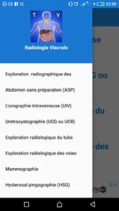 La Radiologique  Viscérale screenshot 2