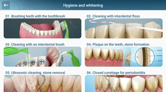 Dental 3D Illustrations screenshot 15