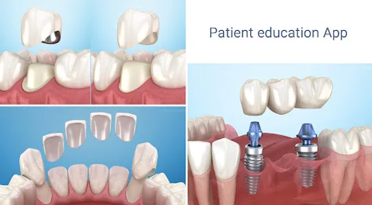 Dental 3D Illustrations screenshot 19