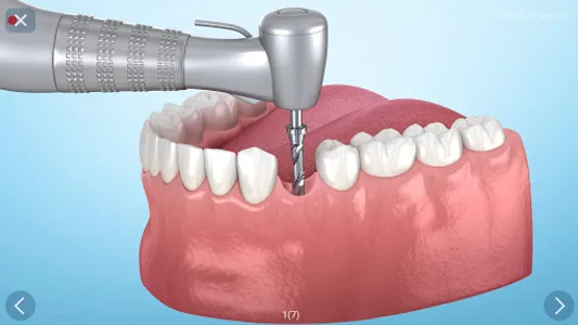 Dental 3D Illustrations screenshot 23