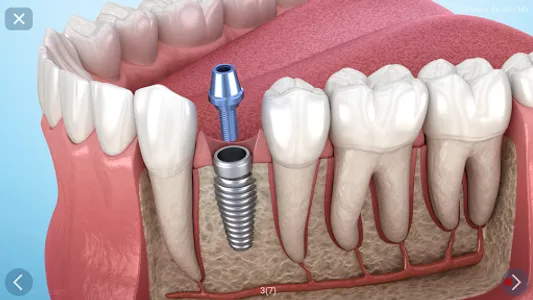 Dental 3D Illustrations screenshot 24