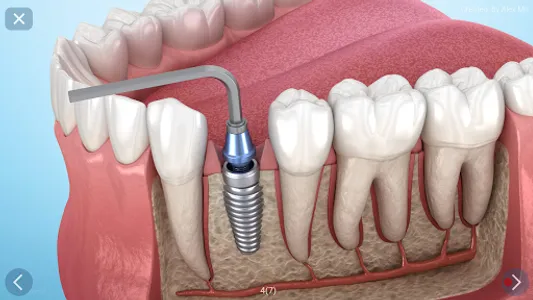 Dental 3D Illustrations screenshot 25