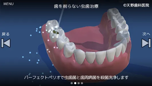 歯を守り隊 screenshot 4