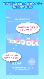 矯正歯磨き貯金 screenshot 0