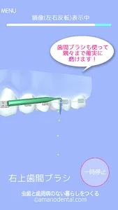 矯正歯磨き貯金 screenshot 4