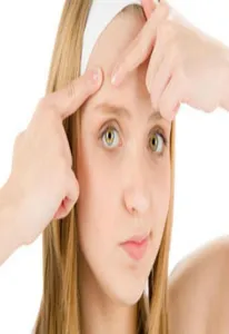 facial acne screenshot 1