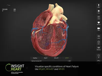 INSIGHT HEART screenshot 11