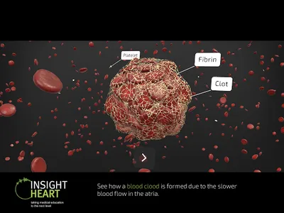 INSIGHT HEART screenshot 13