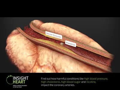 INSIGHT HEART screenshot 14