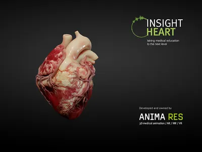 INSIGHT HEART screenshot 15