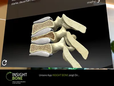 INSIGHT BONE screenshot 10