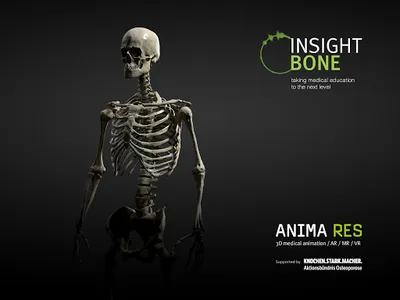 INSIGHT BONE screenshot 12