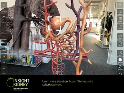 INSIGHT KIDNEY screenshot 11