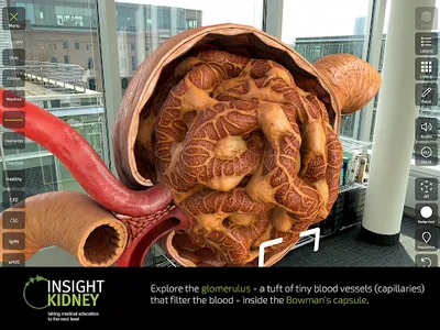 INSIGHT KIDNEY screenshot 12