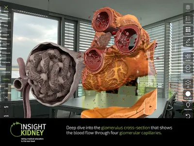 INSIGHT KIDNEY screenshot 13