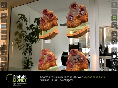 INSIGHT KIDNEY screenshot 14