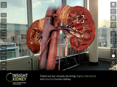 INSIGHT KIDNEY screenshot 18