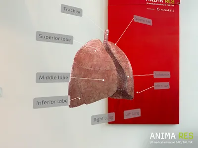 INSIGHT LUNG Enterprise screenshot 10