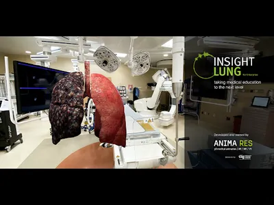 INSIGHT LUNG Enterprise screenshot 16