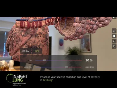 INSIGHT LUNG screenshot 13