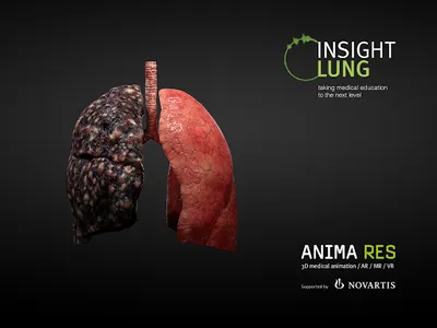 INSIGHT LUNG screenshot 14