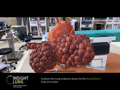 INSIGHT LUNG screenshot 17