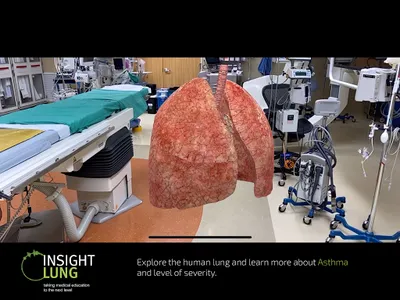 INSIGHT LUNG screenshot 18