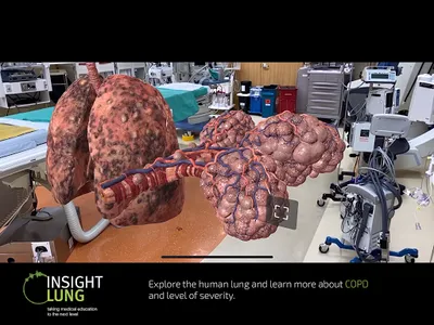 INSIGHT LUNG screenshot 19