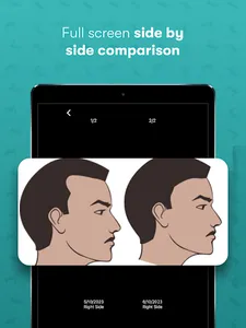 Hairly: Fight Hair Loss screenshot 17