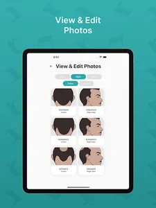 Hairly: Fight Hair Loss screenshot 18