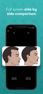 Hairly: Fight Hair Loss screenshot 2