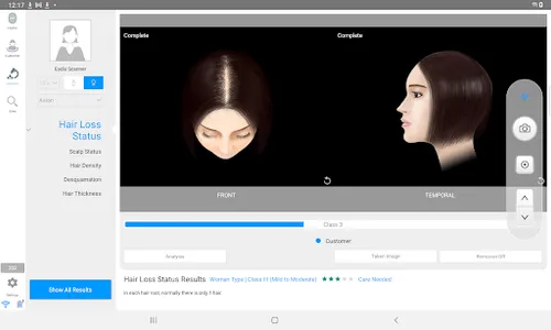 EODIS Hair & Scalp Scanner screenshot 10