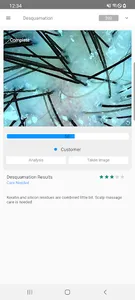 EODIS Hair & Scalp Scanner screenshot 4