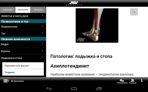 ASA Laser (ru) screenshot 1