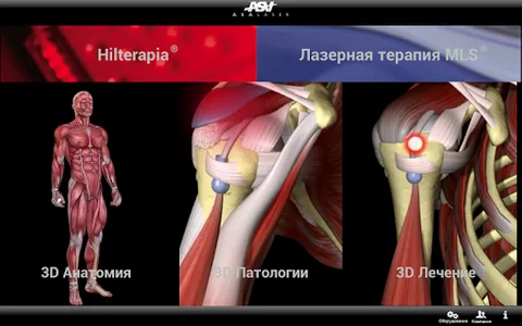 ASA Laser (ru) screenshot 3