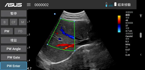 MediConnect – ASUS Ultrasound screenshot 0