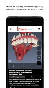 Smile Train screenshot 4