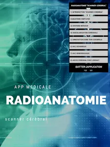 radio-anatomiescanner cérébra screenshot 1