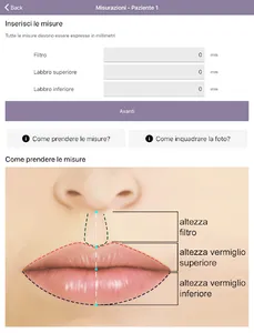 Teoxane Italia Lips screenshot 7