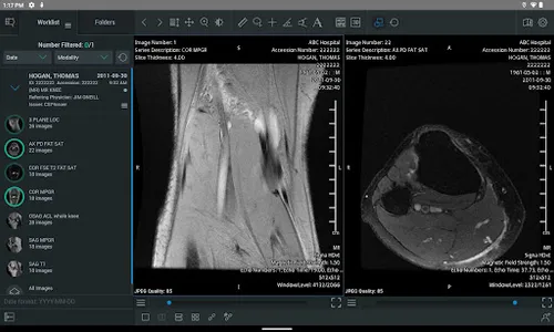 ResolutionMD screenshot 5