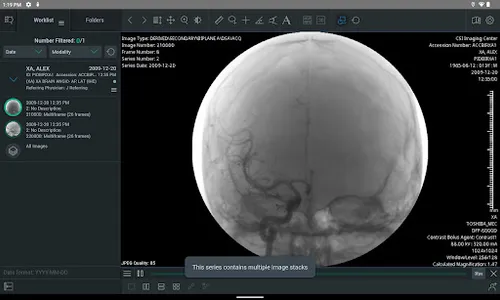 ResolutionMD screenshot 7