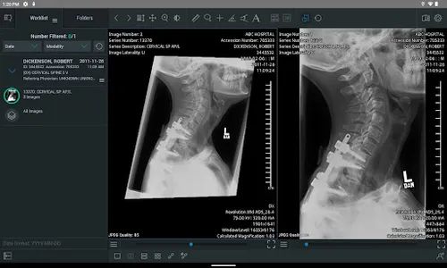 ResolutionMD screenshot 8